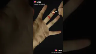Сломал палец