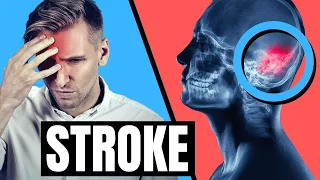 Did you have a STROKE? - F.A.S.T.  Explained - Symptoms, Treatment and Prevention