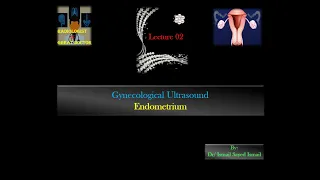 Gynecological Ultrasound -Lecture 02 -Endometrium