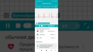 Смарт часы с суточной записью АД и интервалов ЭКГ