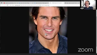 Tom Cruise facial surgery analysis