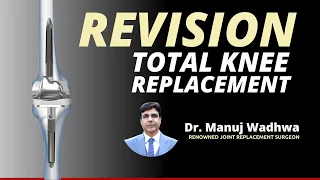 Revision Total Knee Replacement - Dr. Manuj Wadhwa - World Renowned Joint Replacement Surgeon