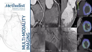 CTA for Assessment of Coronary Anatomy and Physiology (Su Min Chang, MD) December 3, 2019