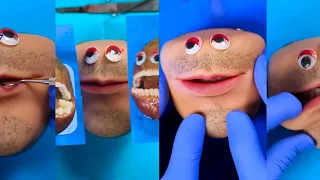 Fruit Surgery with Mr. Kiwi! Original Mr. Kiwi Episodes! Discount Dentist | TikTok | Fleeting Films