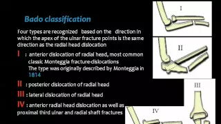 Skeletal fractures II Upper Limb  Prof  Dr  Mamdouh Mahfouz 720p