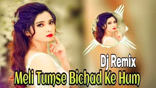 Mile Tumse Bichad Ke Hum | DJ Remix Song | Hindi Best Song | 90s Dj Song |DJ Remix Song | Bollywood