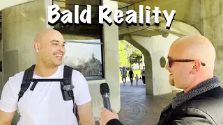 The Truth About Being Bald