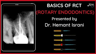 BASICS of RCT | ROTARY ENDODONTICS - Step by Step | TIPS & TRICKS!!