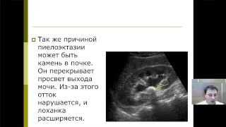 Вебинар №5 Тема:  «Особенности ультразвуковой диагностики метаболических нарушений».