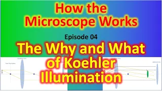 The Why and What of Koehler Illumination