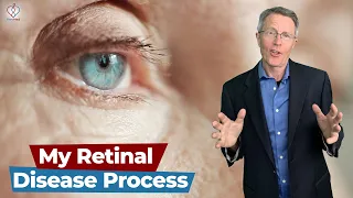 How to Detect Drusen - My Retinal Disease Checkup Process