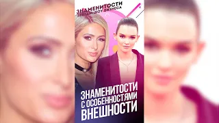 Знаменитости с особенностями внешности / #shorts