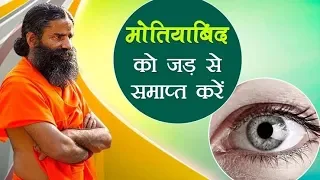 मोतियाबिंद (Cataract) के लिए सर्जरी नहीं, काफी हैं ये घरेलू इलाज | Swami Ramdev