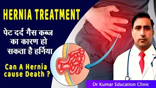 HERNIA TREATMENTपेट दर्द गैस कब्ज का कारण हो सकता है हर्निया//Can A Hernia cause Death ?