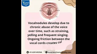 Vocal Nodules#vocalnodules #kenthomeopathyclinic #drkukrejakalani#hiranandanipowai#mumbai#8291492566