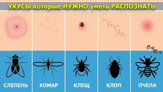 Укусов Насекомых Которые Нужно уметь Распознавать