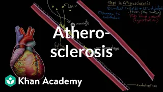 Atherosclerosis | Circulatory System and Disease | NCLEX-RN | Khan Academy