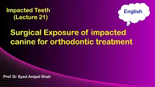 Surgical Exposure of Impacted Canine for Orthodontic Treatment | English | Syed Amjad Shah