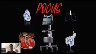 Fluid management in COVID  J Wilkinson