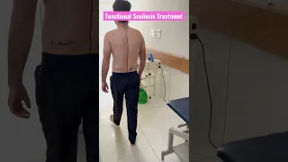 Scoliosis Treatment By DrRavi #scoliosis #scoliosistreatment #spine #pain #scoliosiscourse #discpain