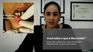 Você sabe o que é Mucocele?