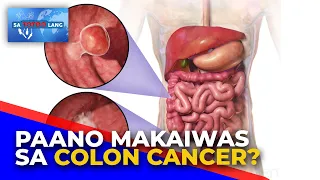 Anong mga dapat kainin para maiwasan ang colon cancer?