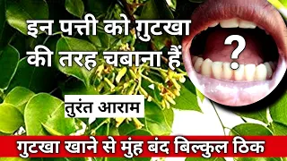 मुंह खोलने की दवा क्या है । oral submucous fibrosis treatment in ayurveda [oral health ]