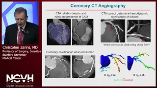 Dr. Christopher Zarins, The Role of CCT Angiography Anatomical and Functional Assessment