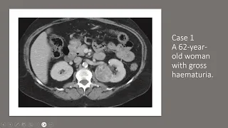 genitourinary cases part 1