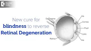 How a new cure for blindness reverses retinal degeneration? - Dr. Sunita Rana Agarwal