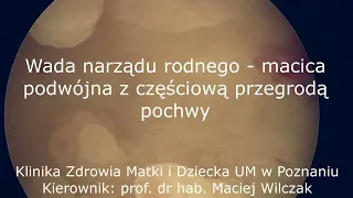 Wada narządów płciowych - macica podwójna z częściową przegrodą pochwy