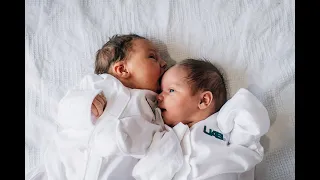 Double uterus, double babies: Alabama mom delivers rare twins at UAB