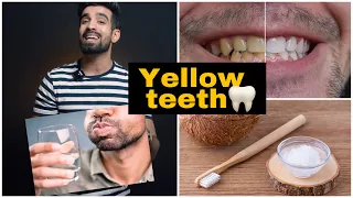Yellow Teeth Cure *Natural*🦷🥥 #shorts #yellowteeth