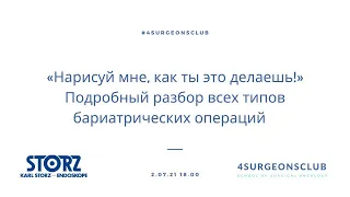 «Нарисуй мне, как ты это делаешь!» Подробный разбор всех типов бариатрических операций