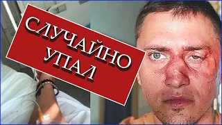 Павла Прилучного избили? | Кого боится актер? |