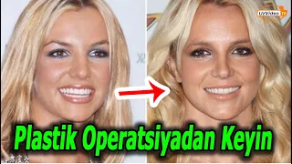 Burnini plastik operatsiya qildirgan mashhurlar - Dunyo mashhurlari !!!