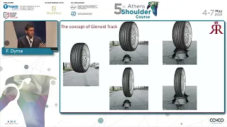 On-track/Off-track lesions. MRI and CT evaluation. How to apply it in your routine - Felix Dyrna