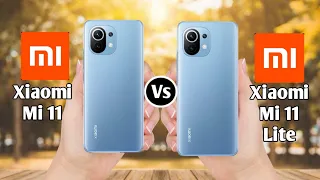 Xiaomi Mi 11 Vs Xiaomi Mi 11 Lite