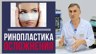 РИНОПЛАСТИКА: 🆘Осложнения | Чего бояться пациенту?