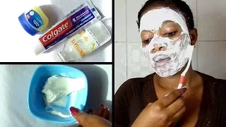 Every Night Apply Baking Soda And Toothpaste On The Face In 5 Minutes Watch What Happens