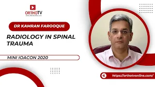 Lecture Radiology in spinal trauma - Kamran Farooque