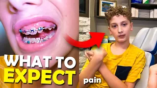 I got braces... (what to expect in the first few days)