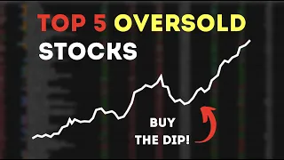 5 Oversold Stocks to Buy NOW📈