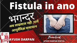 आइये जानें भगंदर ||Fistula in ano || की बिना ऑपरेशन आयुर्वेदिक़ चिकित्सा