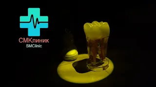 🤣Ирина Кайратовна (ПАРОДИЯ) 5к Шакензо & Бакалек Хайноллаев #стоматология Атырау 5000 тренд хит