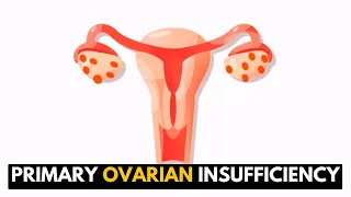 Primary Ovarian Insufficiency: What It Means for Your Health