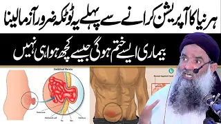 Hernia Ka Gharelu ilaaj | Hernia Exercises Without Surgery | Dr Sharafat Ali