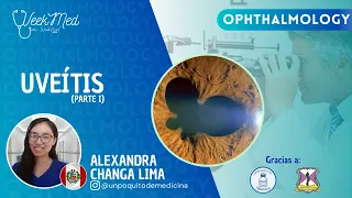 UVEITIS