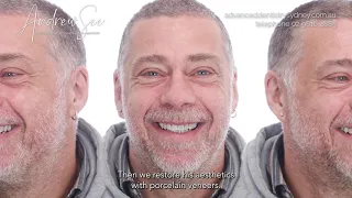 Dental implants and smile transformation - Cristiano's Journey