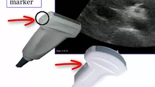 Introduction to Radiology: Ultrasound